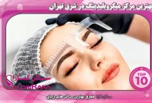 بهترین مرکز میکروبلیدینگ در شرق تهران